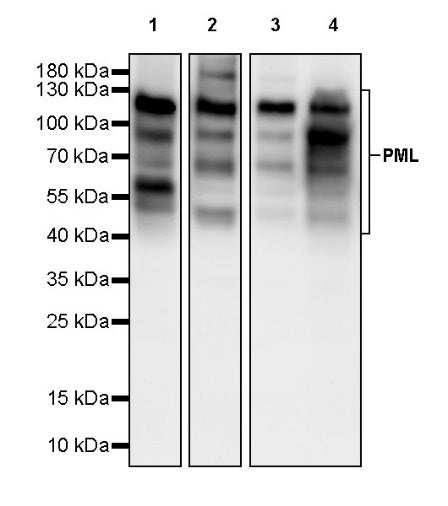 PML Recombinant Rabbit mAb (S-1908-60)