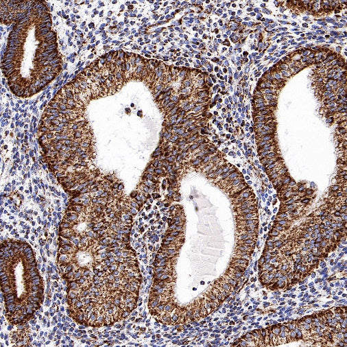 VDAC1 Recombinant Rabbit mAb (S-1877-18)