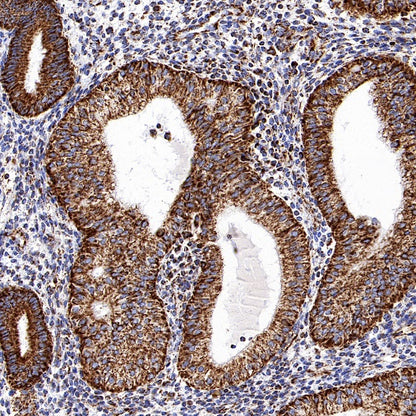 VDAC1 Recombinant Rabbit mAb (S-1877-18)
