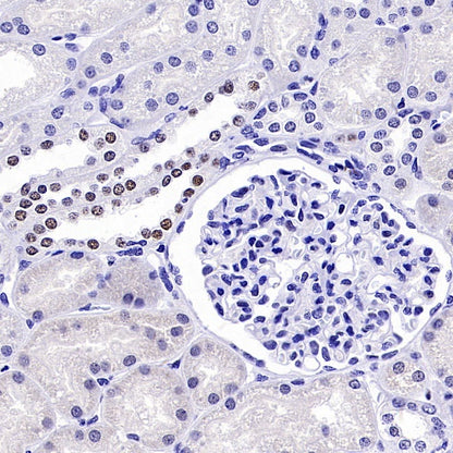 KDM4A Recombinant Rabbit mAb (S-957-138)