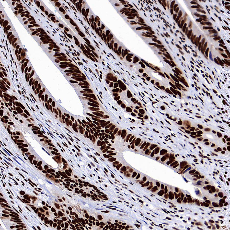 SMC1 Recombinant Rabbit mAb (S-4147-54)