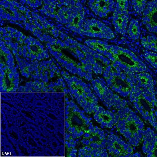 TOM20 Recombinant Rabbit mAb (SDT-2553-11)