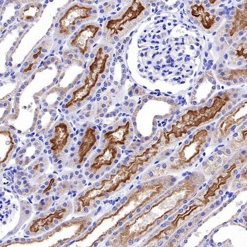 MRP2 Recombinant Rabbit mAb (S-2316-41)