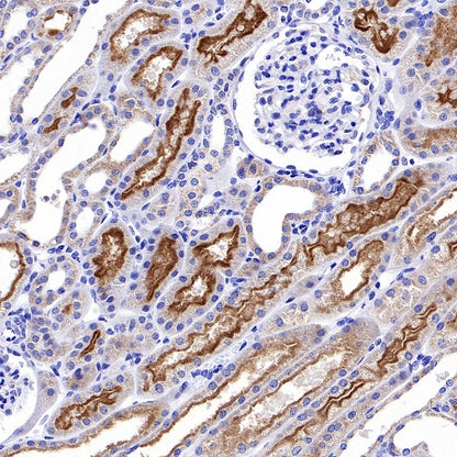 MRP2 Recombinant Rabbit mAb (S-2316-41)