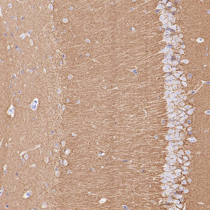 SV2A Recombinant Rabbit mAb (S-2096-2)