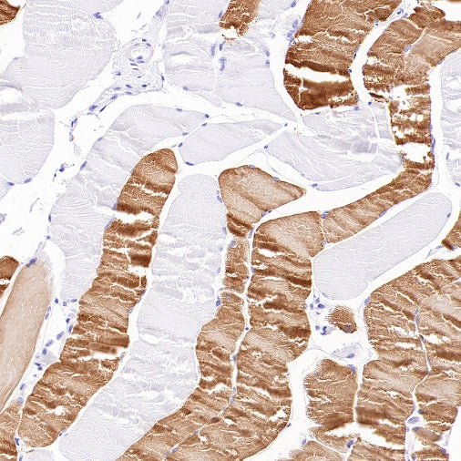 MYH7 Recombinant Rabbit mAb ,PBS Only (SDT-2936-44)