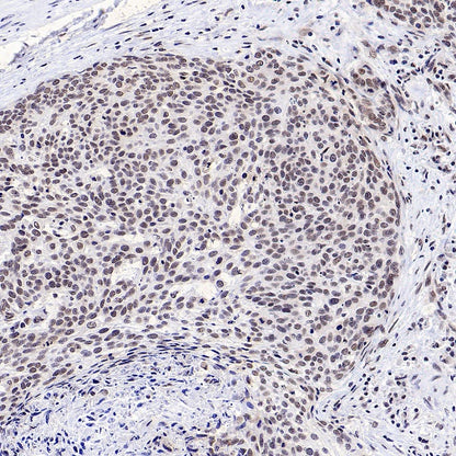 SF2 Recombinant Rabbit mAb (S-1845-27)