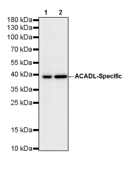 ACADL-Specific Recombinant Rabbit mAb