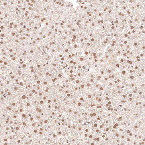 RUVBL1 Recombinant Rabbit mAb (S-1600-38)