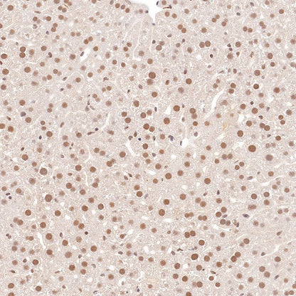 RUVBL1 Recombinant Rabbit mAb (S-1600-38)