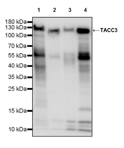 TACC3 Recombinant Rabbit mAb (S-3048-50)