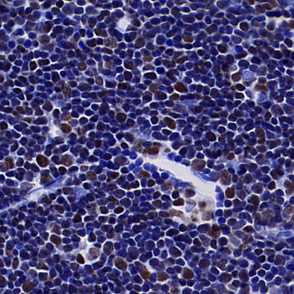 IKZF1 Recombinant Rabbit mAb (S-4176-17)