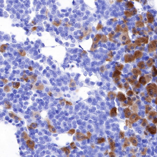 FSHB Recombinant Rabbit mAb (SDT-R287)