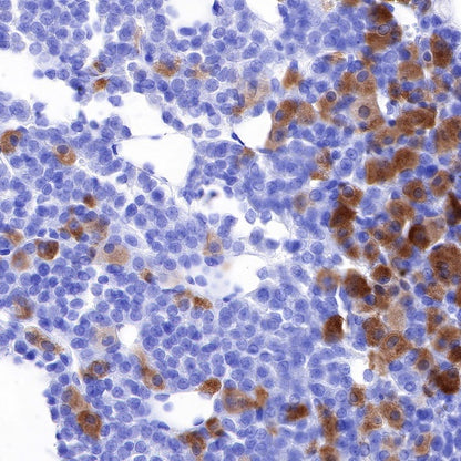 FSHB Recombinant Rabbit mAb (SDT-R287)