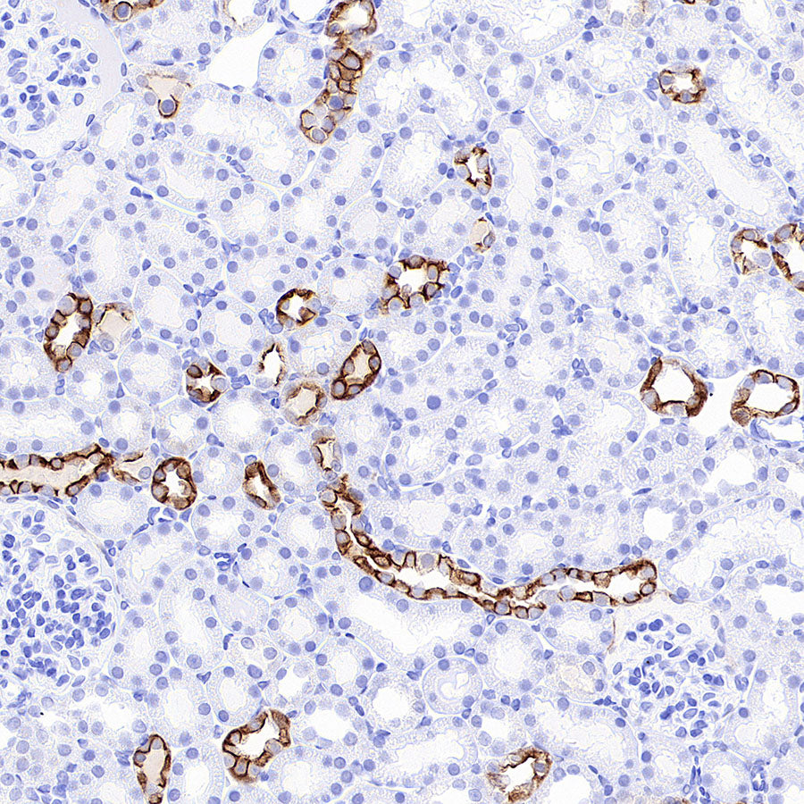 Cytokeratin 7 Recombinant Rabbit mAb (S-5954)