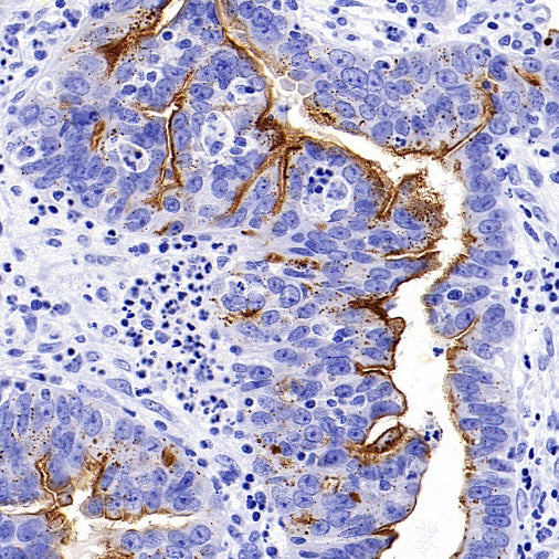 NaPi2b/SLC34A2 Recombinant Rabbit mAb (SDT-R229)