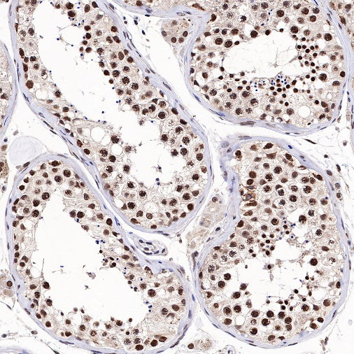 TFE3 Recombinant Rabbit mAb (SDT-760-34)