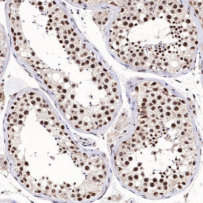 TFE3 Recombinant Rabbit mAb (SDT-760-34)