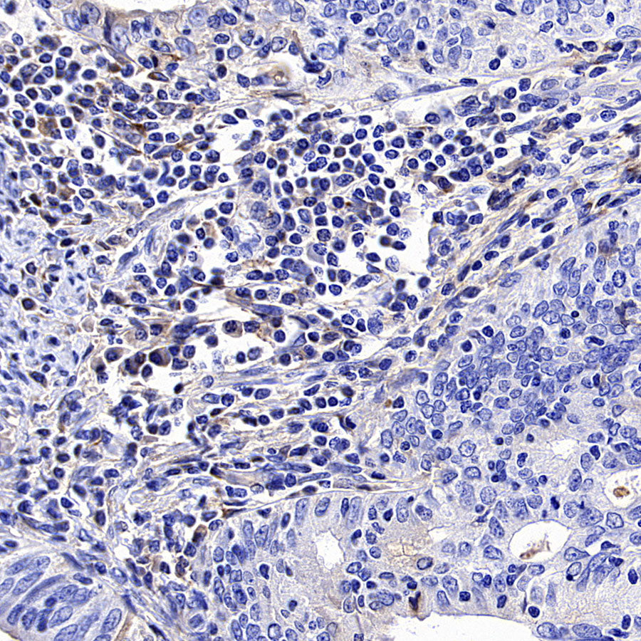 TIMP1 Recombinant Rabbit mAb (S-5147)