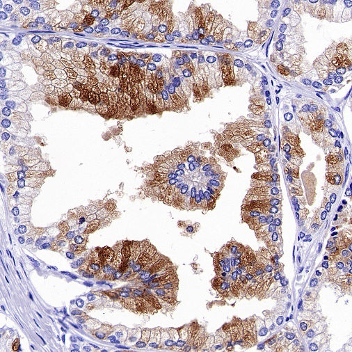 GDF-15 Recombinant Rabbit mAb (S-1012-42)