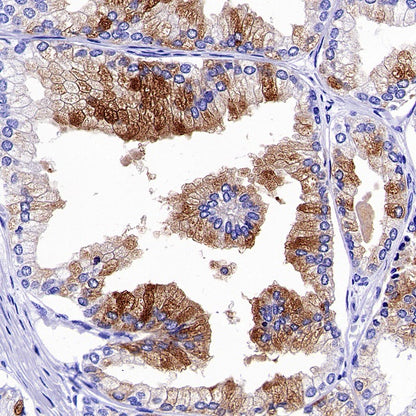GDF-15 Recombinant Rabbit mAb (S-1012-42)