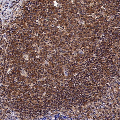 ATIC Rabbit Polyclonal Antibody