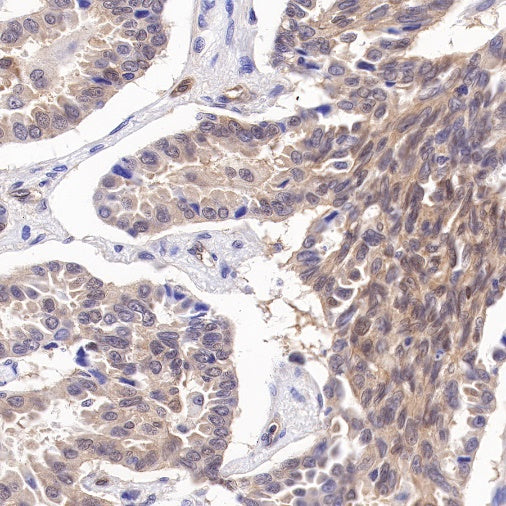 Caspase-7 Recombinant Rabbit mAb (S-R254)