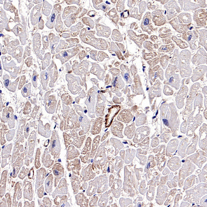 β-actin Recombinant Rabbit mAb (SDT-R156)