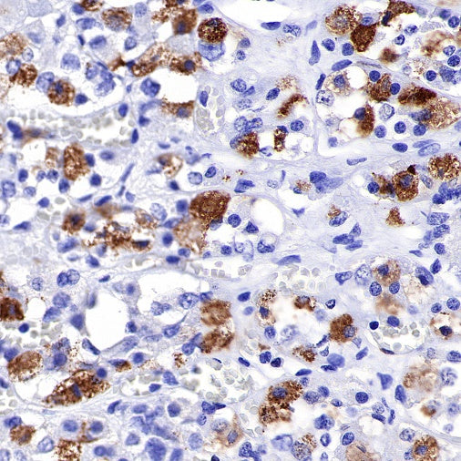 FSHB Recombinant Rabbit mAb (SDT-R287)