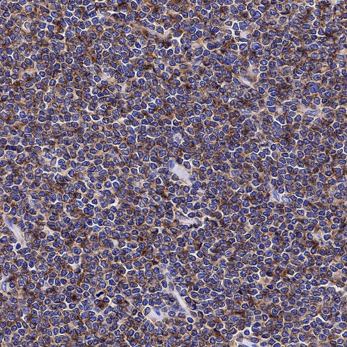 CD19 Recombinant Rabbit mAb (SDT-164-41)