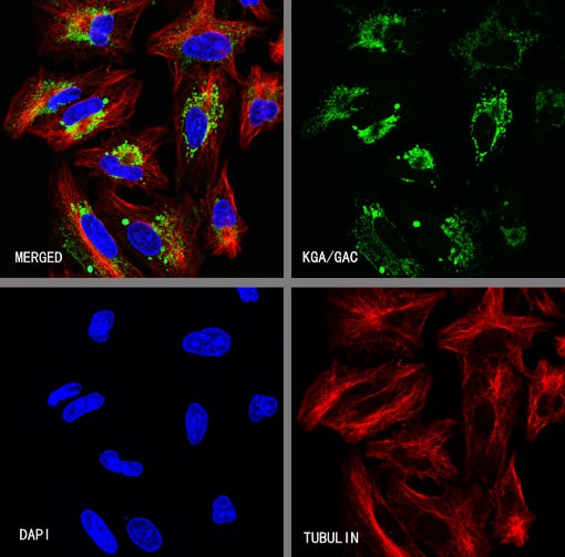 GLS1 Recombinant Rabbit mAb (S-2355-20)