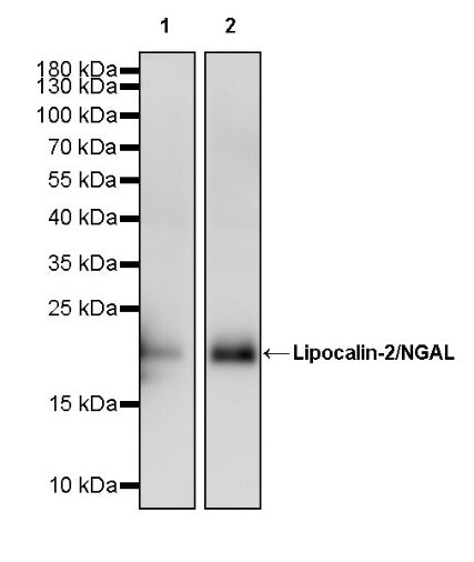 Lipocalin-2/NGAL Recombinant Rabbit mAb (S-2279-72)
