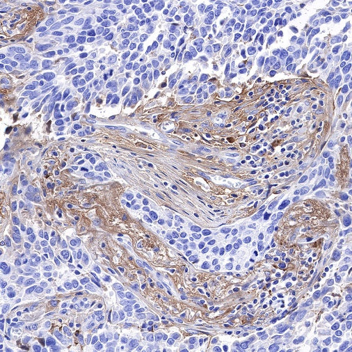 C1q Recombinant Rabbit mAb (S-472-105)