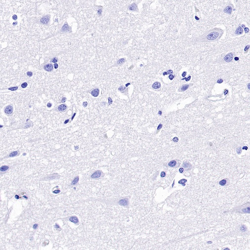 CD6 Recombinant Rabbit mAb (S-1512-39)