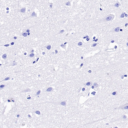 CD6 Recombinant Rabbit mAb (S-1512-39)