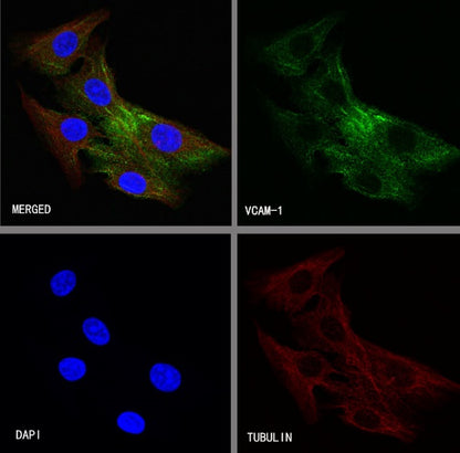 VCAM1 Recombinant Rabbit mAb (S-650-19)