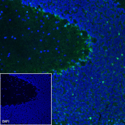 FABP7 Recombinant Rabbit mAb (S-762-114)