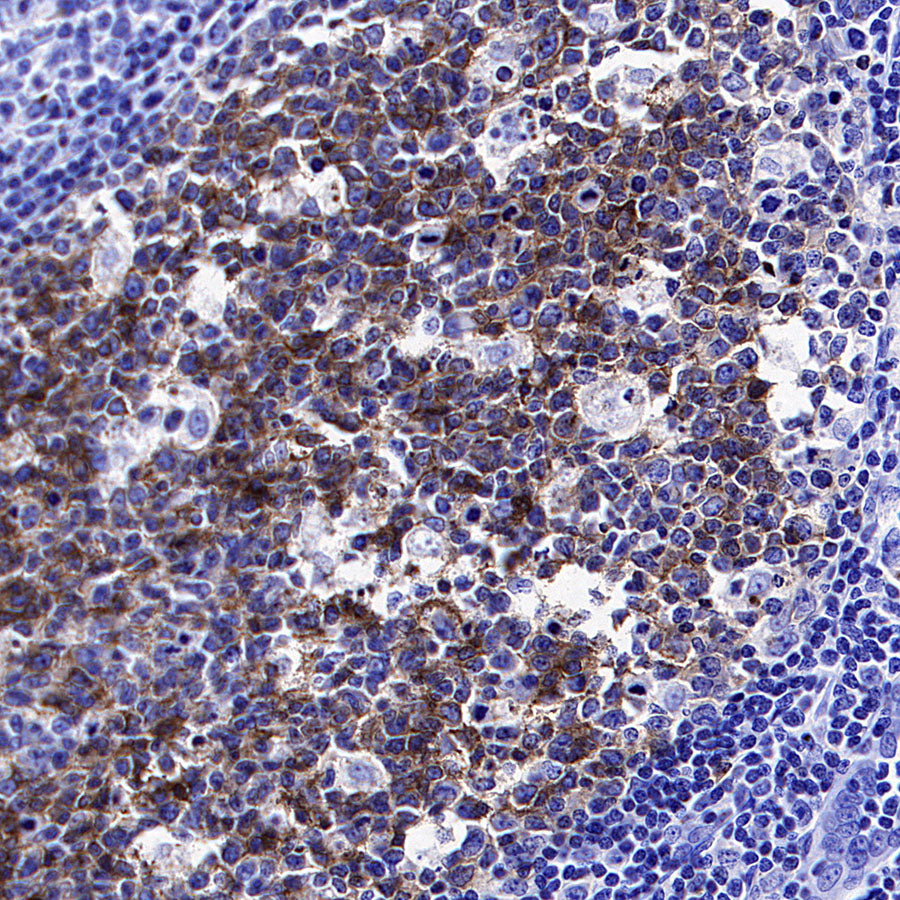 CXCR4 Recombinant Rabbit mAb (S-5318)