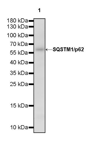 SQSTM1/p62 Recombinant Rabbit mAb (S-778-1)