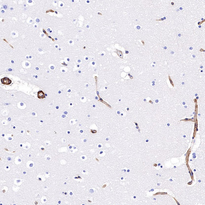 CD239 Recombinant Rabbit mAb (S-683-3)