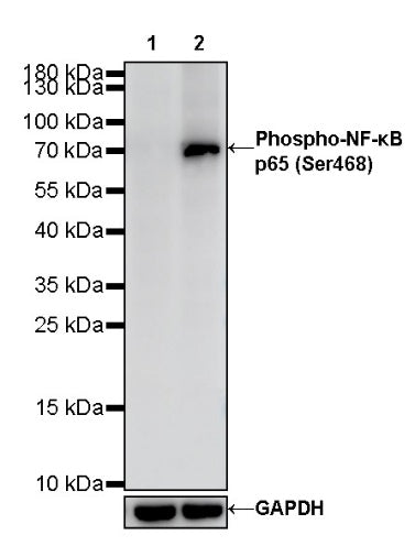 Phospho-NF-κB p65 (Ser468) Recombinant Rabbit mAb (S-1124-133)