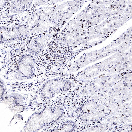 Histone H3 (di methyl K56) Recombinant Rabbit mAb (S-R427)