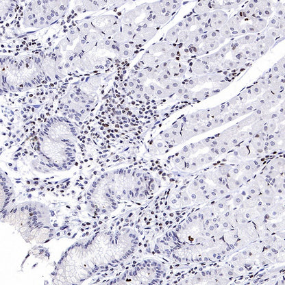 Histone H3 (di methyl K56) Recombinant Rabbit mAb (S-R427)