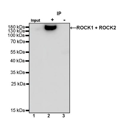 ROCK1+ROCK2 Recombinant Rabbit mAb (S-1305-26)