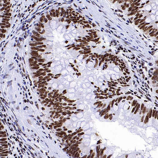 hnRNP H Rabbit Polyclonal Antibody