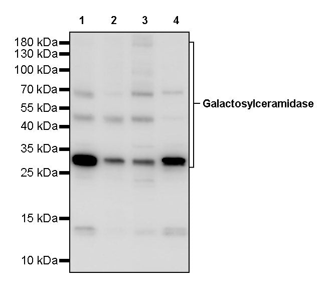 Galactosylceramidase Recombinant Rabbit mAb (S-3402-17)