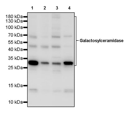 Galactosylceramidase Recombinant Rabbit mAb (S-3402-17)