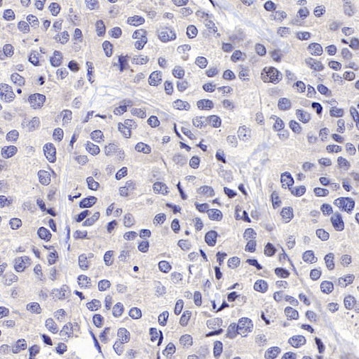 BRCA1 Recombinant Mouse mAb (S-4707)
