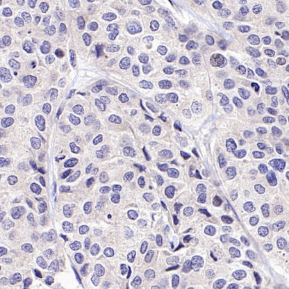 BRCA1 Recombinant Mouse mAb (S-4707)