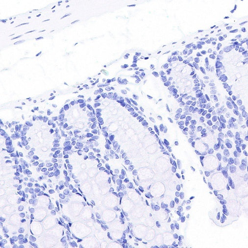 STEAP3 Recombinant Rabbit mAb (S-4466-26)